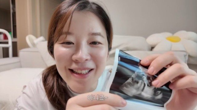 Seunghye Kim reveals fetal movement check at 18-19 weeks of pregnancy: 