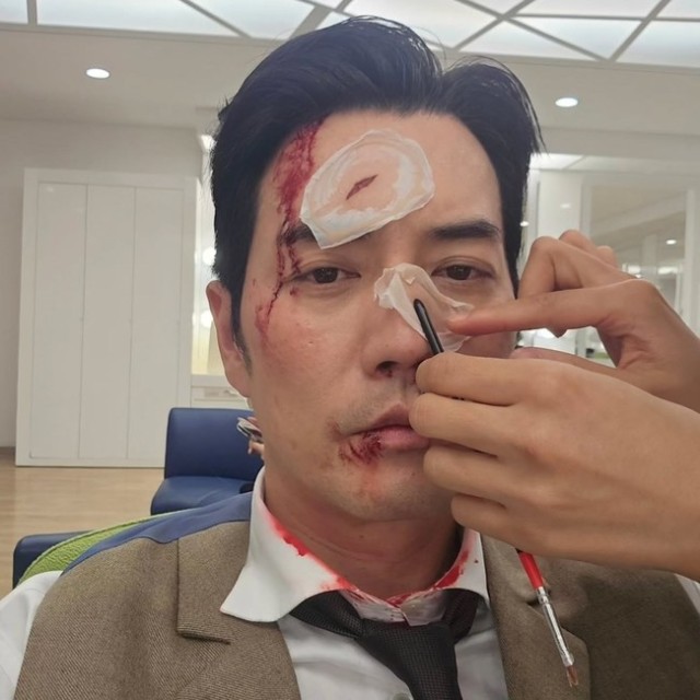 朱相昱,SBS《金部长》淤青妆容公开......