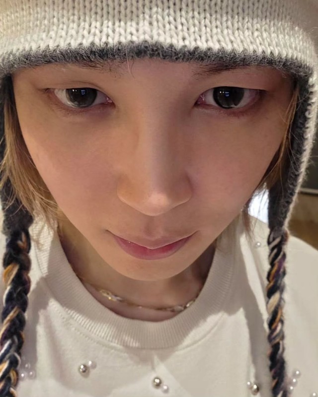 Singer Jimin shares update after fall accident... relaxed daily life with braided hair
