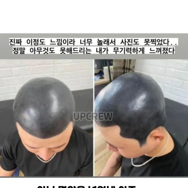 두피문신 대참사.jpg